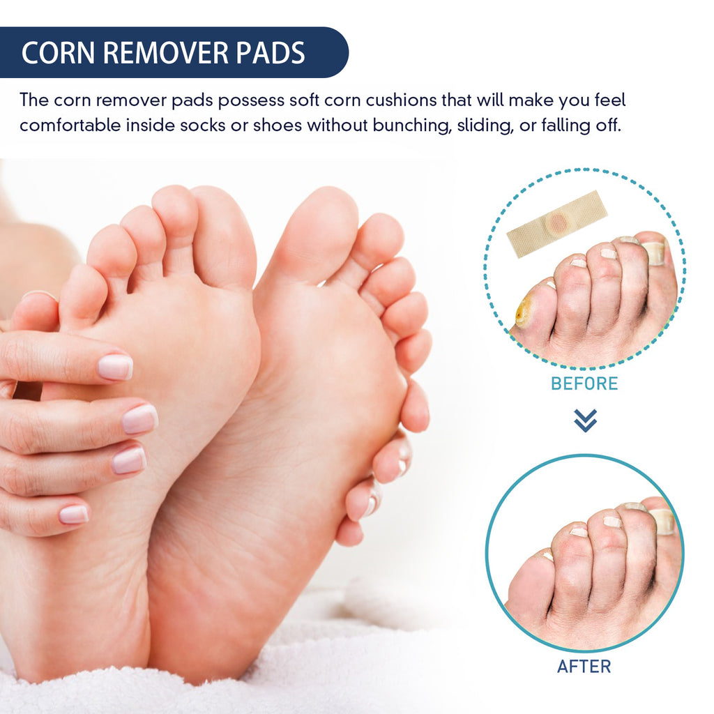South Moon Gram Warty Corns Patch, Foot Soles Chicken Especially Clean Flesh Piercing Wart Wart Repair Patch Plain Sweat Tube Repair Patch