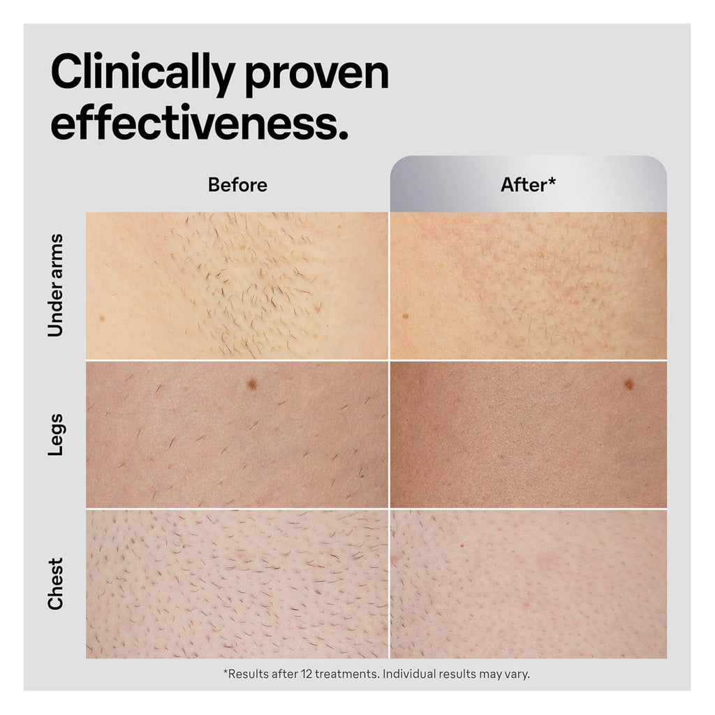 Braun IPL, Silk·Expert Pro 5, IPL Hair Removal for Women and Men, Permanent Laser Hair Reduction At-Home, 2 Heads, Pouch, IPL5137
