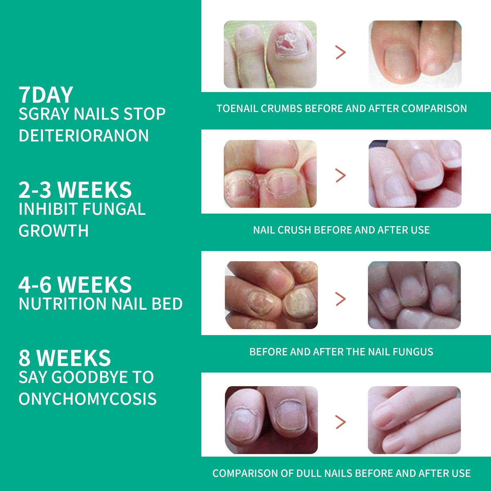 South Moon Nail Care Essence Moisturizes And Cleanses Hands, Feet And Nails And Brightening Nails Daily Care Essence