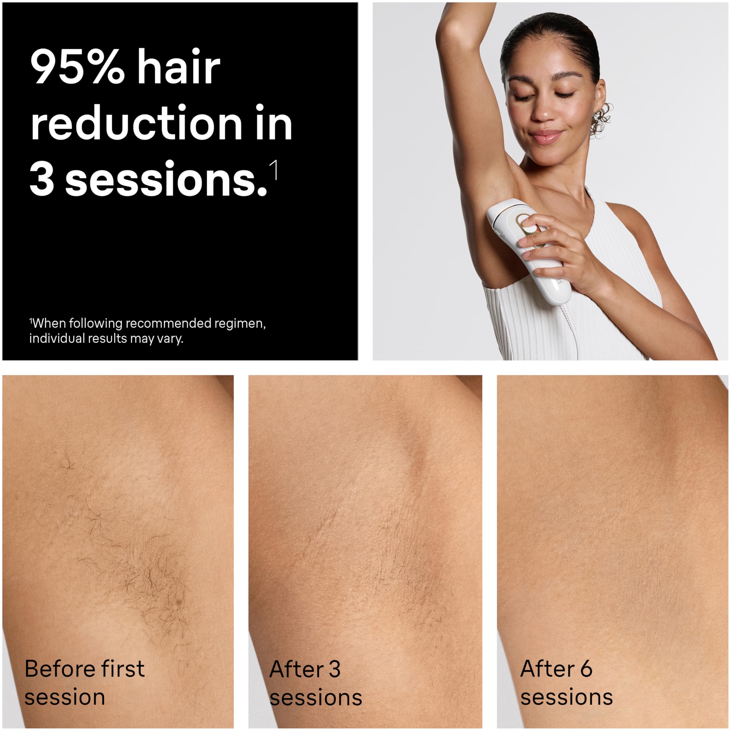 Braun IPL, Silk·Expert Pro 5, IPL Hair Removal for Women and Men, Permanent Laser Hair Reduction At-Home, 2 Heads, Pouch, IPL5137