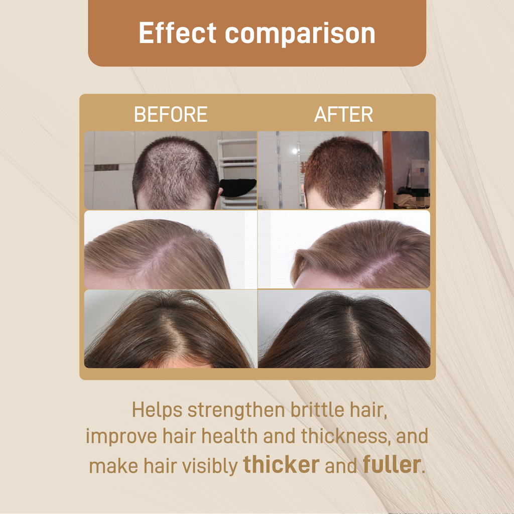 Googeer Dense Hair Dietary Supplement Drops Nourishes Roots, Prevents Breakouts And Strengthens Hair Care Supplements