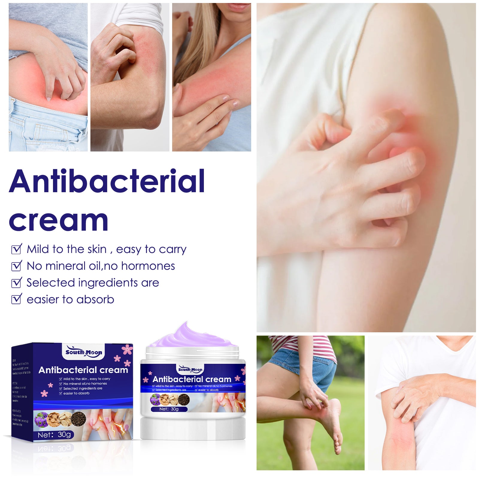 South Moon Zihuadidian Skin Care Cream For Mosquito Bites And Red Skin Topical Care Cream
