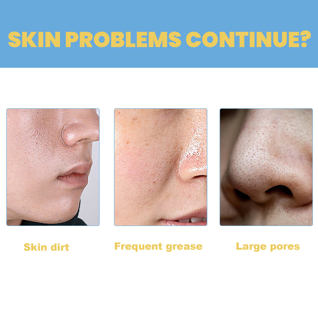 EELHOE Oligopeptide Mini Bubble Cleansing Essence, Pore-Tightening Skin Gentle Deep Clean Blackhead Acne