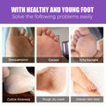 EELHOE Ginger Foot Mask (Box) Foot Moisturizing, Nourishing, Rejuvenating, Exfoliating, Removing Dead Skin, Dry And Cracked Skin Care Foot Mask