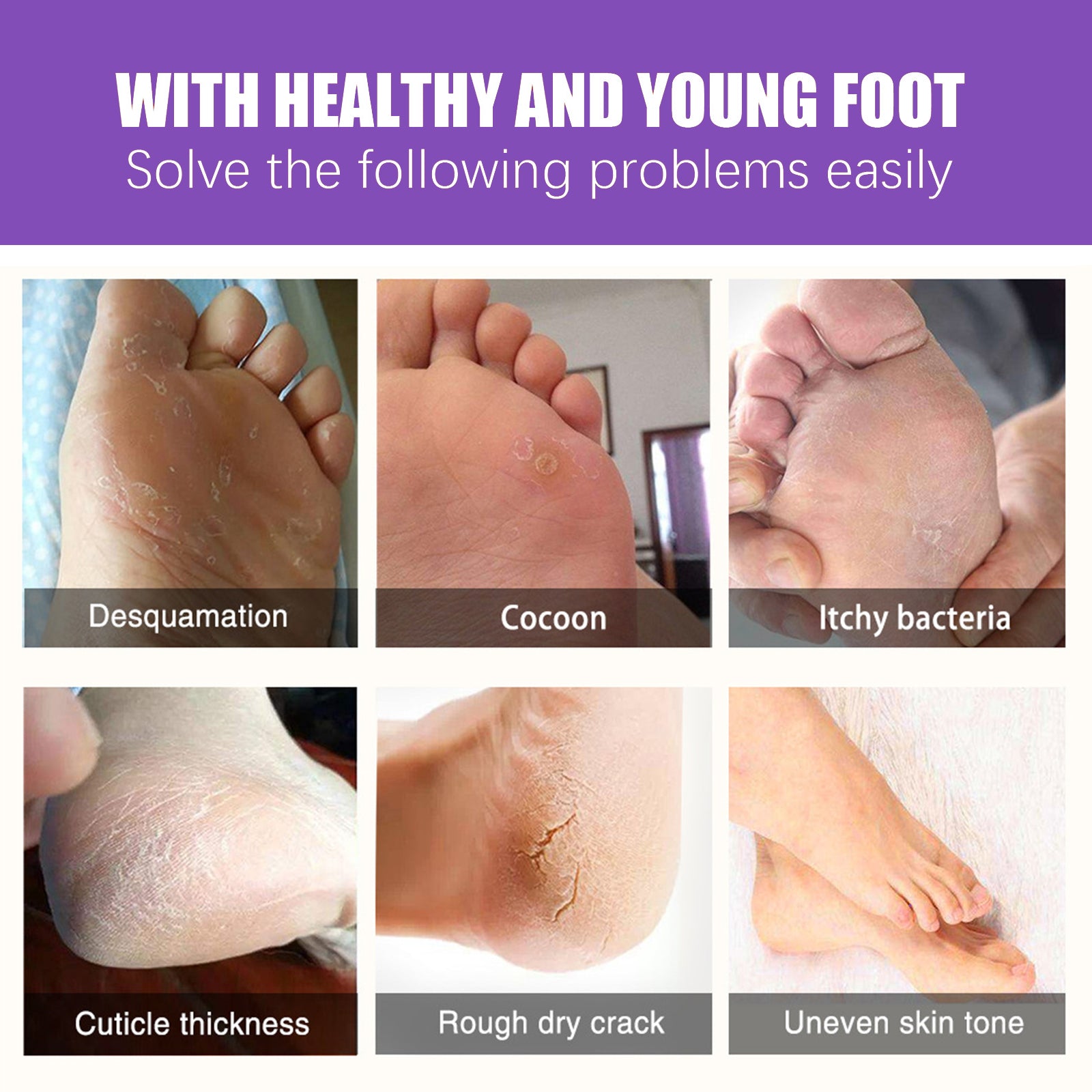 EELHOE Ginger Foot Mask (Box) Foot Moisturizing, Nourishing, Rejuvenating, Exfoliating, Removing Dead Skin, Dry And Cracked Skin Care Foot Mask