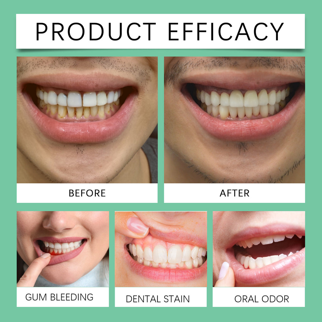 Oral Gums Mild Care Gel, Gentle Gum Care Gel Highly Effective Soothing Formula To Repair Gums And Improve Oral Health