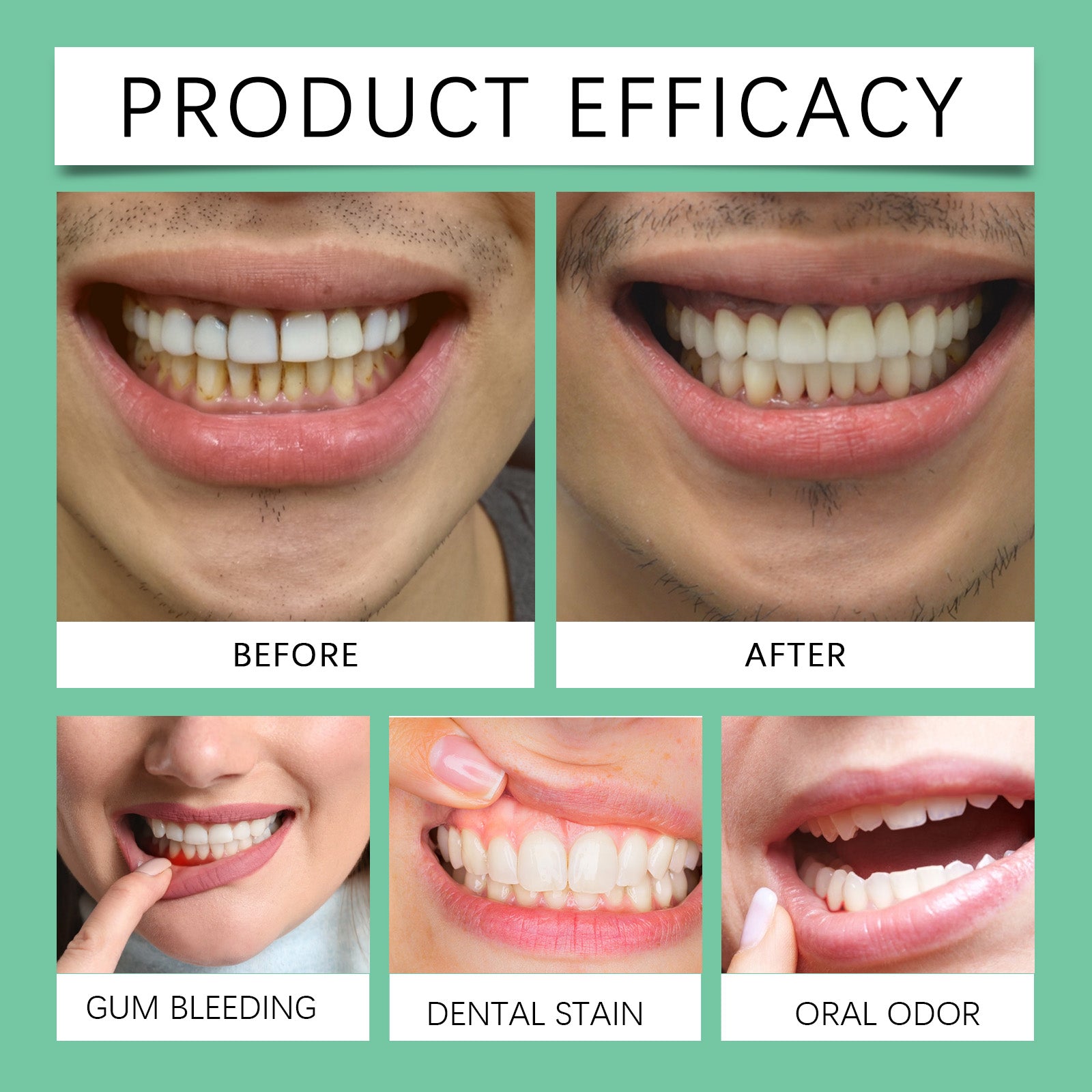 Oral Gums Mild Care Gel, Gentle Gum Care Gel Highly Effective Soothing Formula To Repair Gums And Improve Oral Health